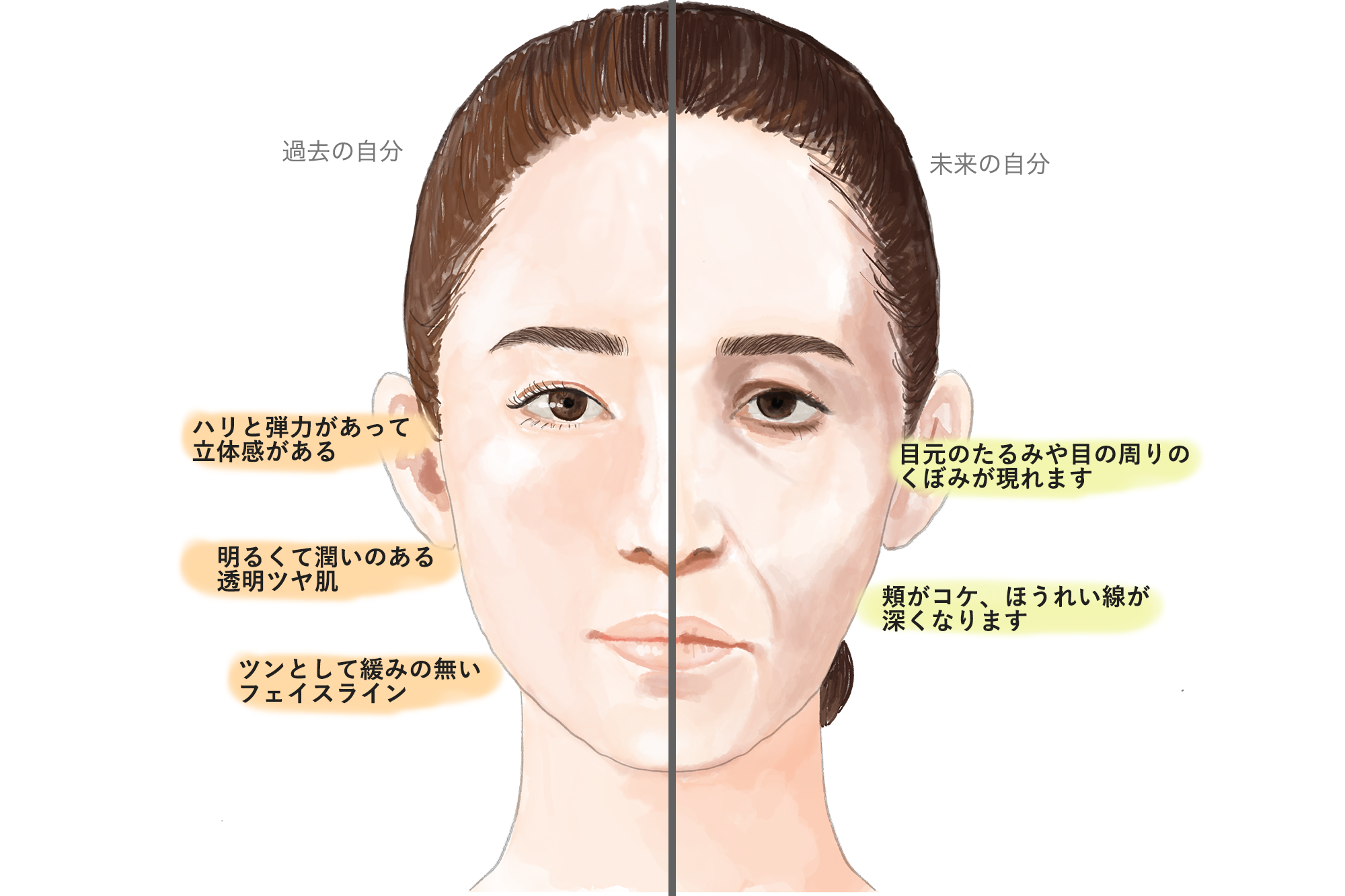 racosie(ラコシェ)肌の菲薄化ってご存じですか？